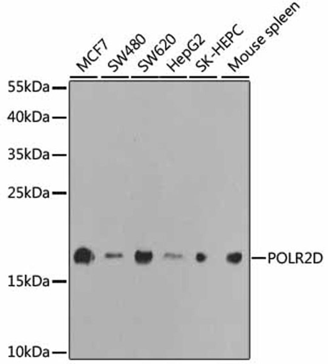 Western blot - POLR2D antibody (A1859)