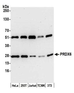 Detection of human and mouse PRDX6 by western blot.