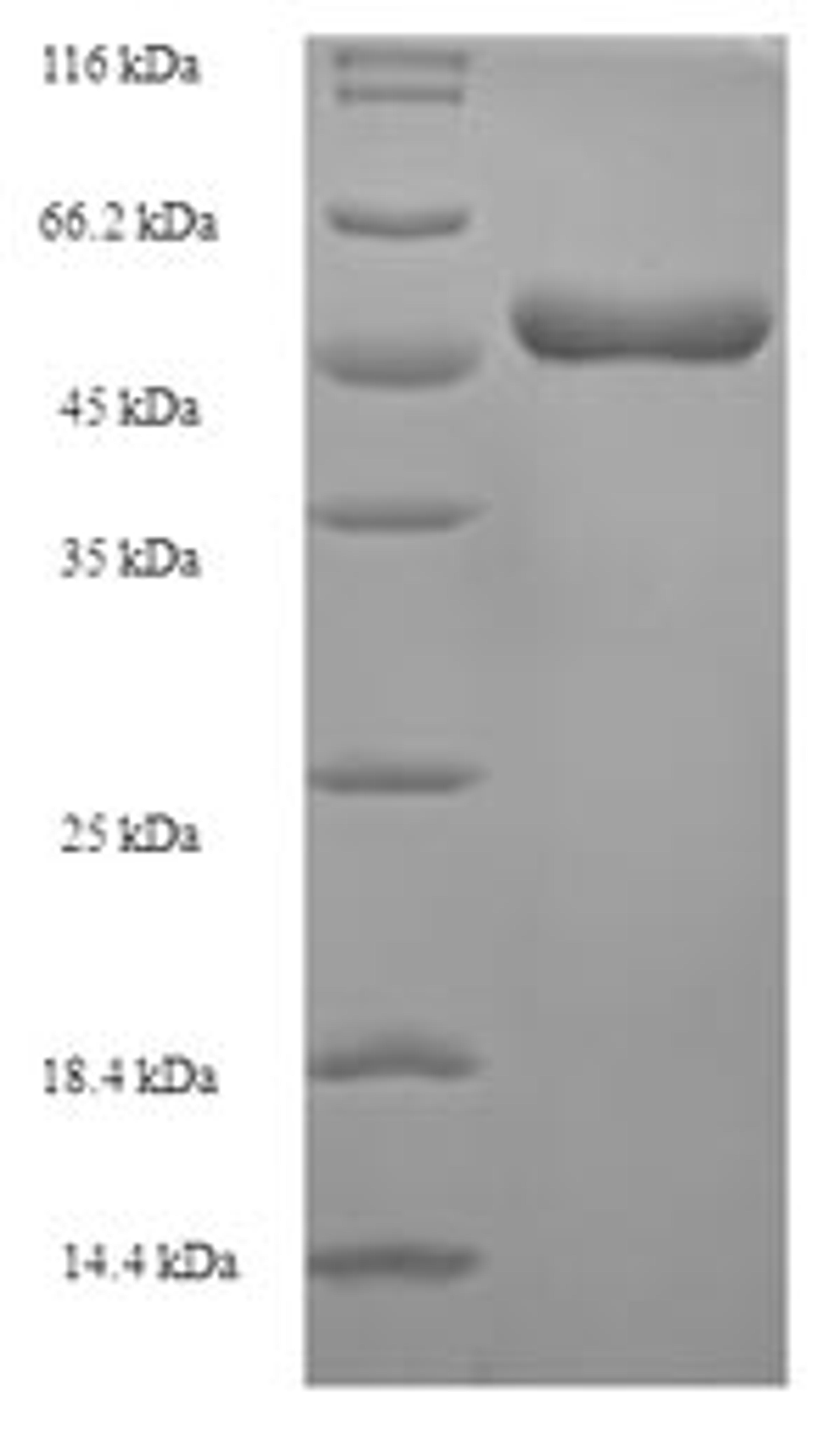 (Tris-Glycine gel) Discontinuous SDS-PAGE (reduced) with 5% enrichment gel and 15% separation gel.