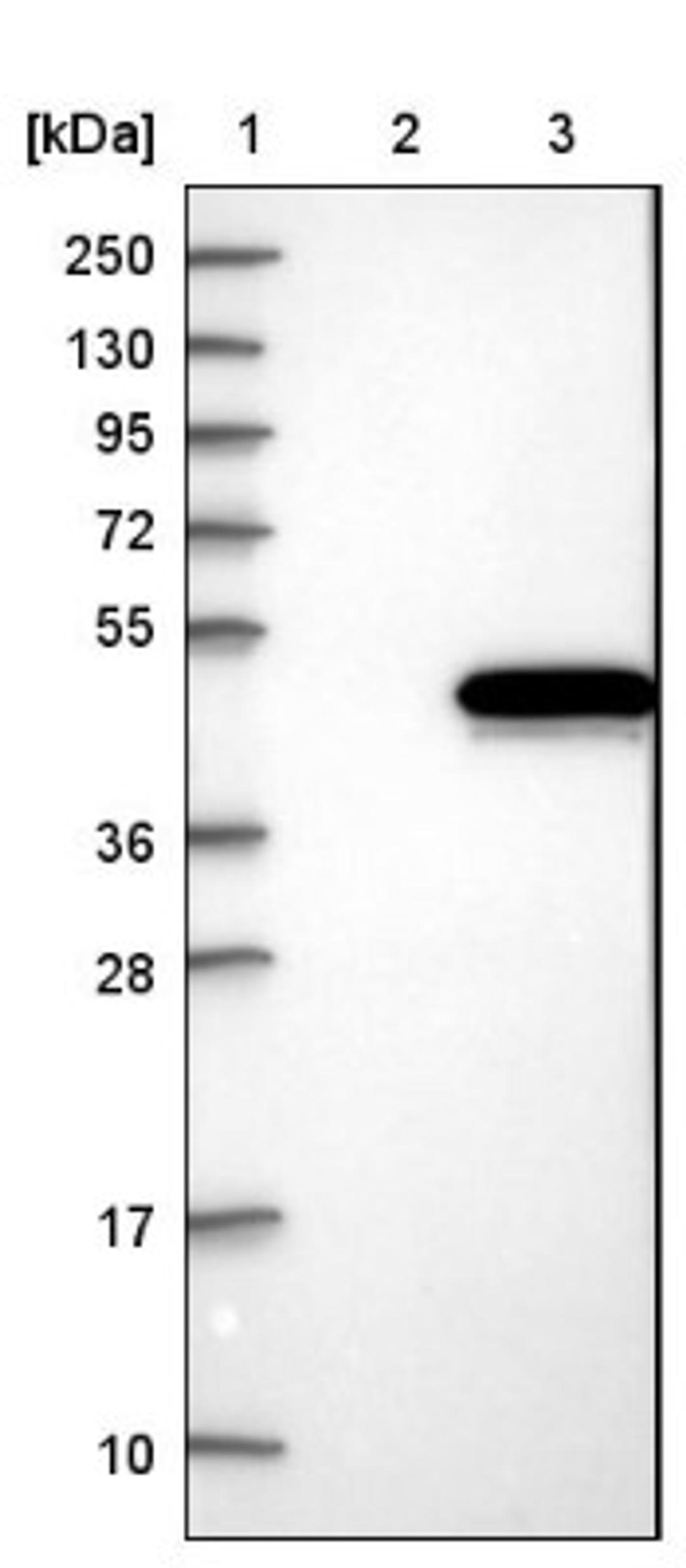 Western Blot: aurora A-binding protein Antibody [NBP1-81152] - Lane 1: Marker [kDa] 250, 130, 95, 72, 55, 36, 28, 17, 10<br/>Lane 2: Negative control (vector only transfected HEK293T lysate)<br/>Lane 3: Over-expression lysate (Co-expressed with a C-terminal myc-DDK tag (~3.1 kDa) in mammalian HEK293T cells, LY411413)