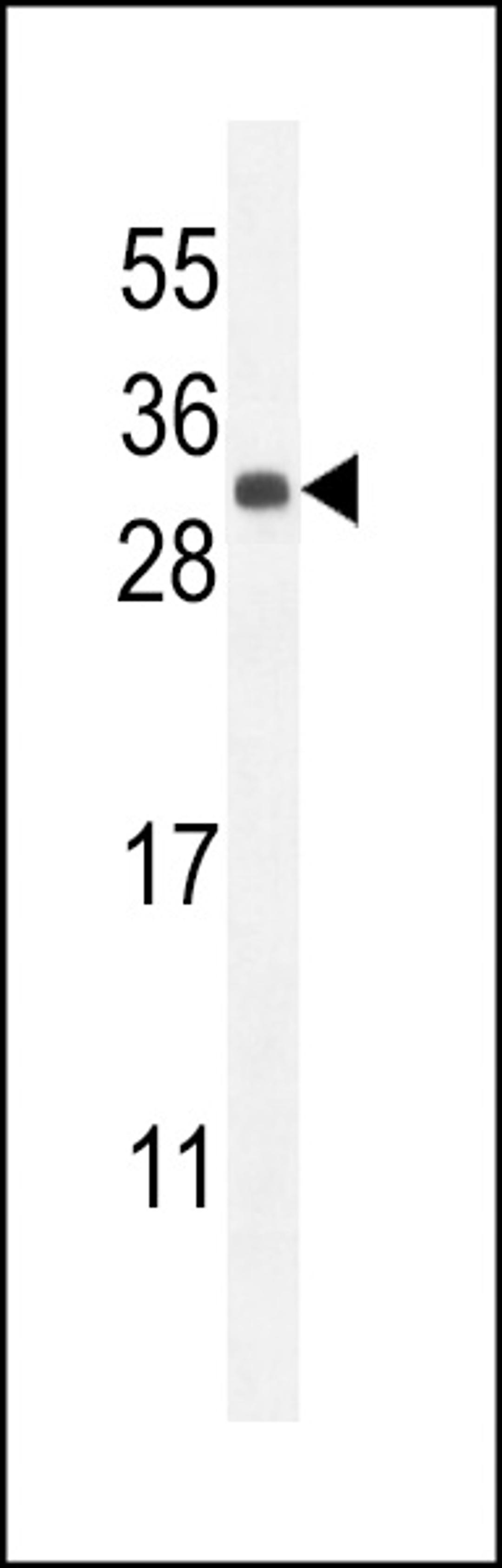 Western blot analysis in mouse kidney tissue lysates (35ug/lane).