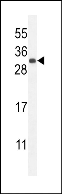 Western blot analysis in mouse kidney tissue lysates (35ug/lane).