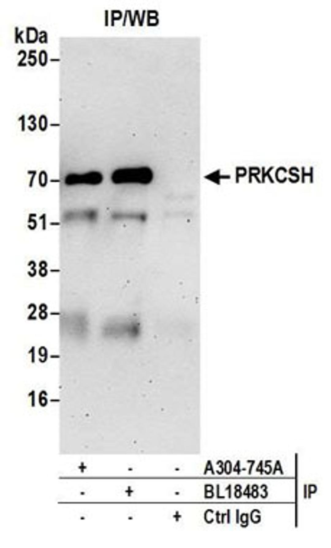 Detection of human PRKCSH by western blot of immunoprecipitates.