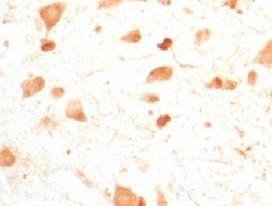 IHC testing of FFPE rat cerebellum with PGP9.5 antibody (clone UBCE-L1).