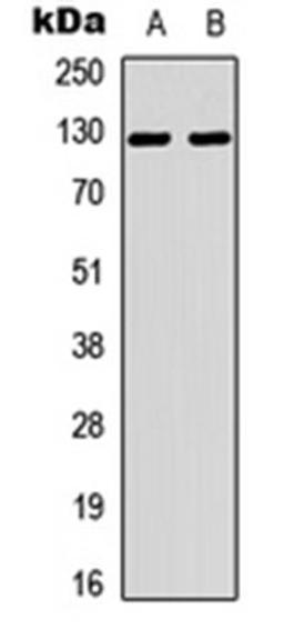 Western blot analysis of A549 (Lane 1), NIH3T3 (Lane 2) whole cell lysates using Tensin 2 antibody