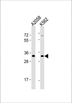 Western Blot at 1:1000 dilution Lane 1: A2058 whole cell lysate Lane 2: K562 whole cell lysate Lysates/proteins at 20 ug per lane.