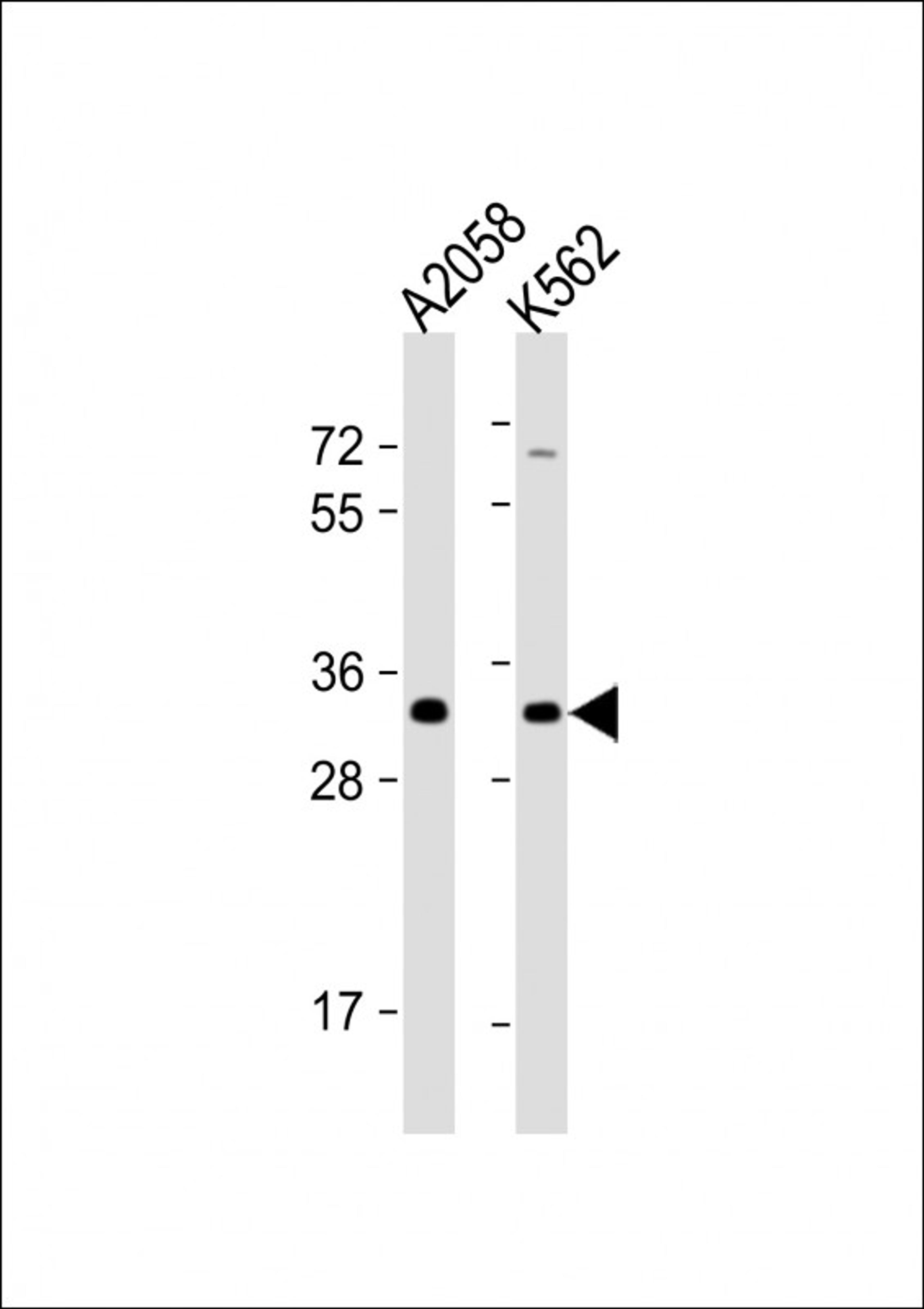 Western Blot at 1:1000 dilution Lane 1: A2058 whole cell lysate Lane 2: K562 whole cell lysate Lysates/proteins at 20 ug per lane.