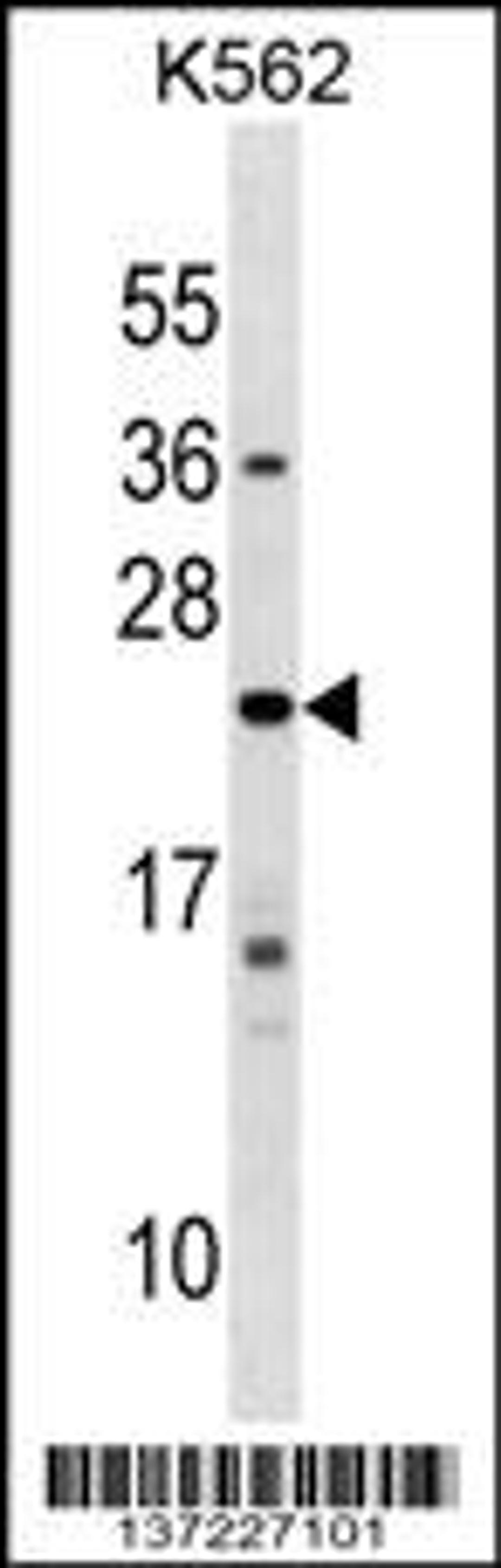 Western blot analysis in K562 cell line lysates (35ug/lane).