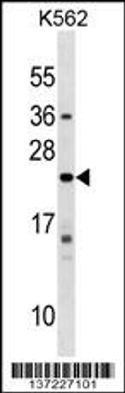 Western blot analysis in K562 cell line lysates (35ug/lane).