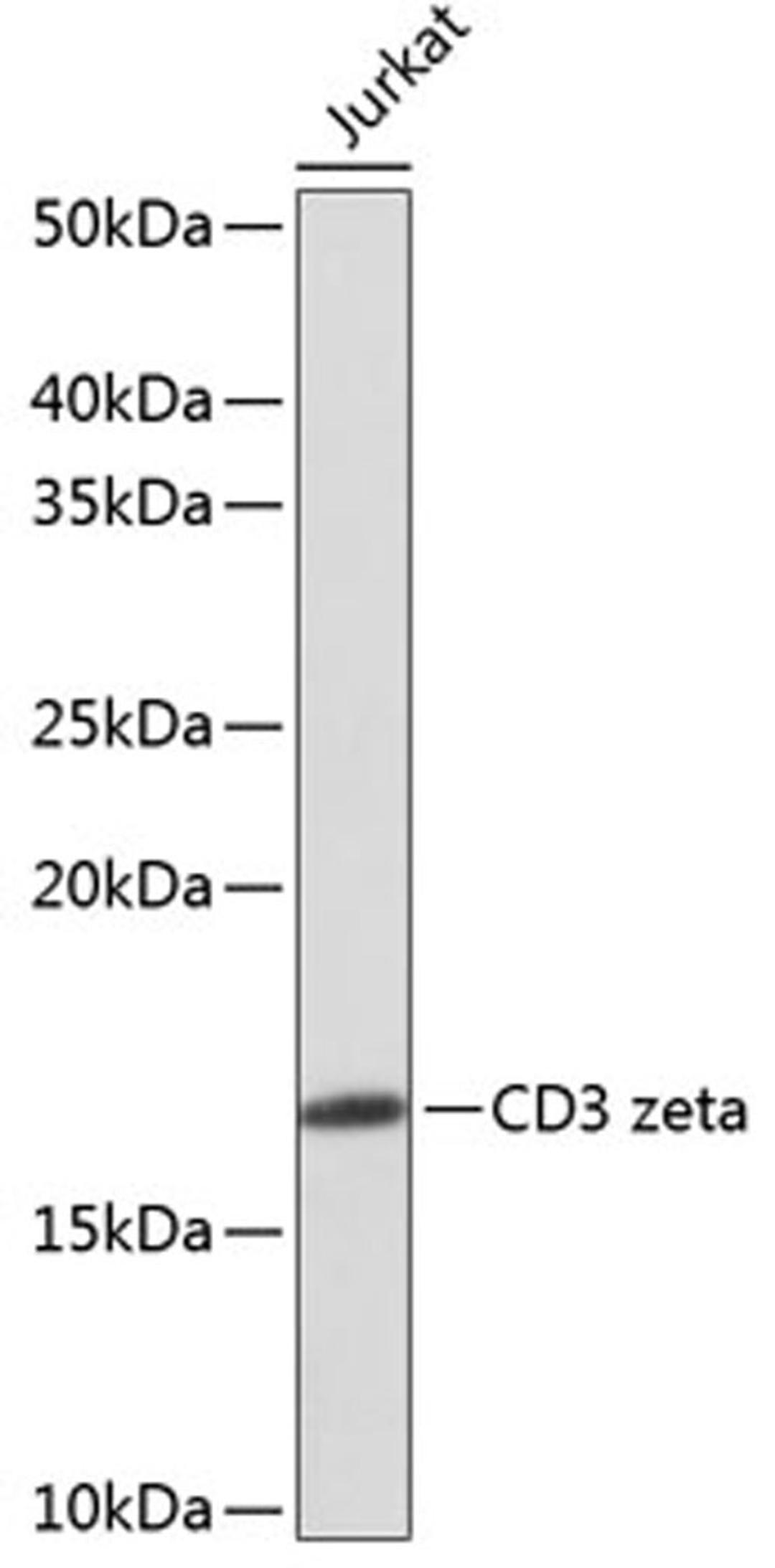 Western blot - CD3 zeta Rabbit mAb (A11157)