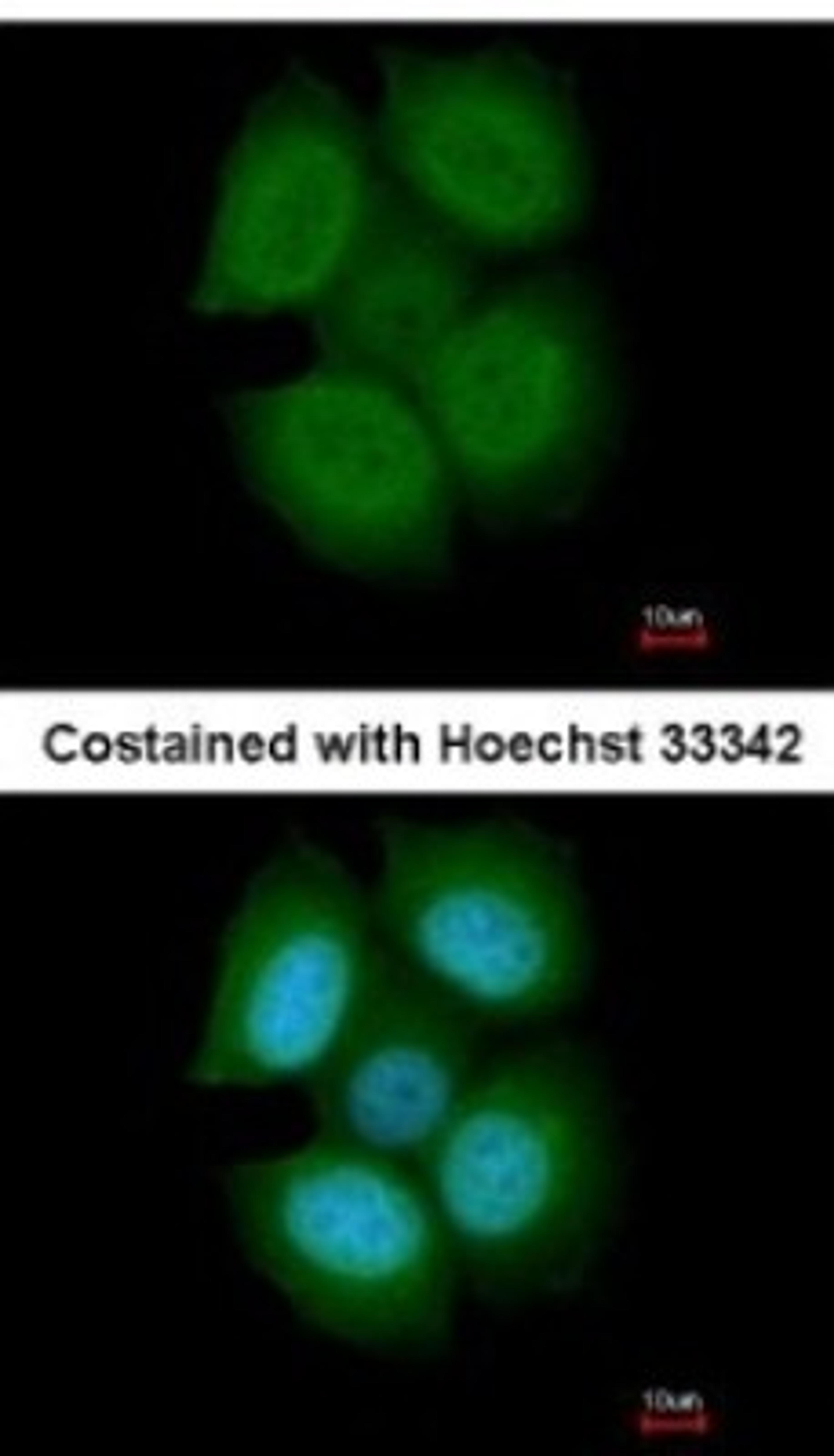 Immunocytochemistry/Immunofluorescence: NXF3 Antibody [NBP2-19614] - Analysis of paraformaldehyde-fixed MCF-7, using antibody at 1:200 dilution.