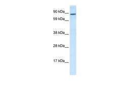 Antibody used in WB on Human Placenta at 0.2-1 ug/ml.