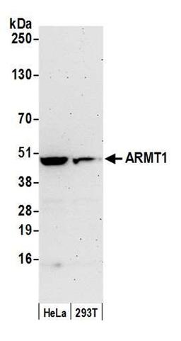 Detection of human ARMT1 by WB.