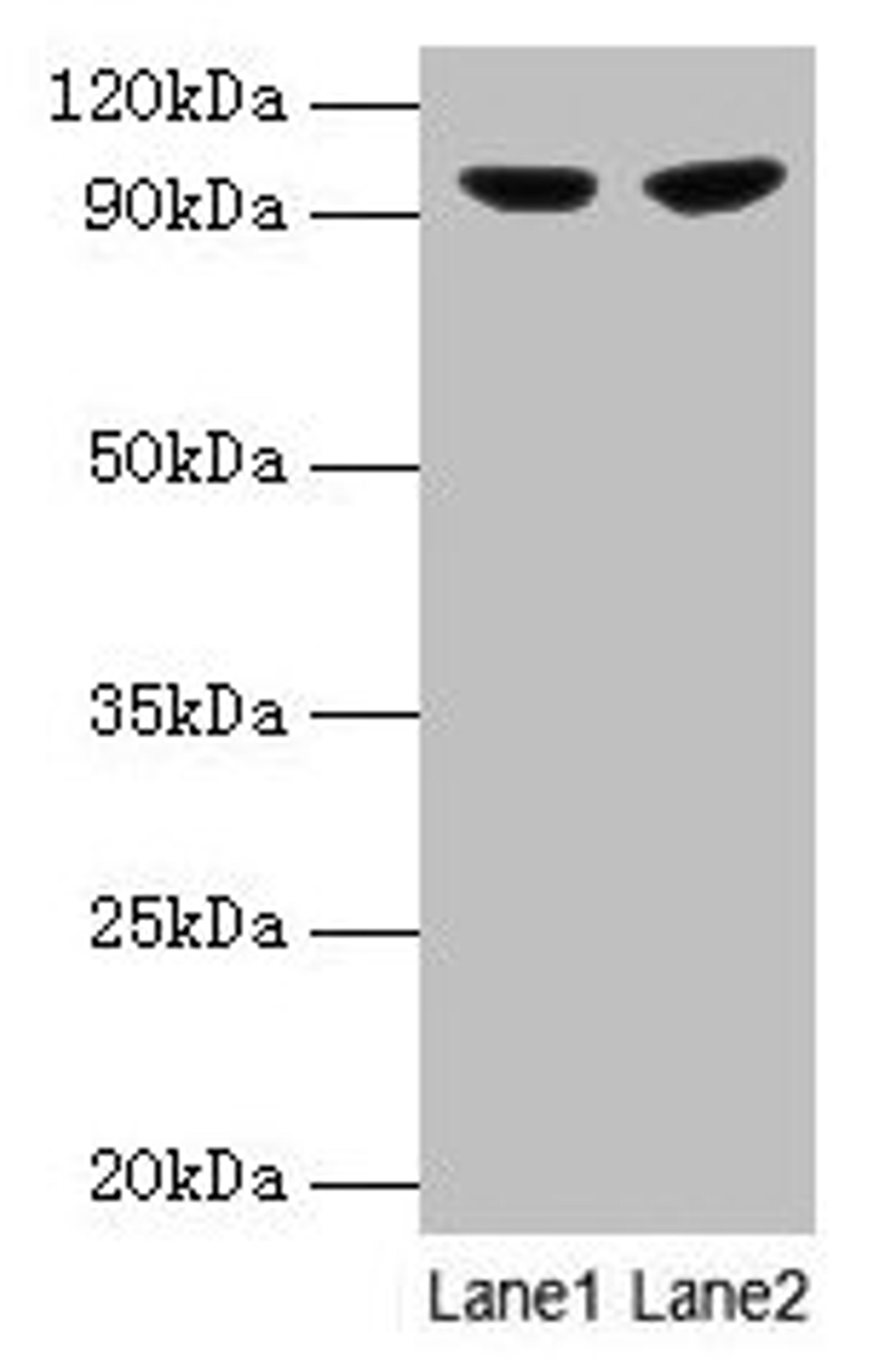 Western blot. All lanes: PYGL antibody at 2µg/ml. Lane 1: 293T whole cell lysate. Lane 2: HepG2 whole cell lysate. Secondary. Goat polyclonal to rabbit IgG at 1/10000 dilution. Predicted band size: 98, 94 kDa. Observed band size: 98 kDa
