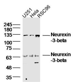 Western blot analysis of Human U251 cell lysates (Lane 1) , Human Hela lysates (Lane 2) , Human Rsc96 cell lysates (Lane 3) using Neurexin-3-beta antibody.