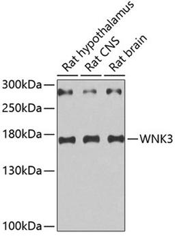 Western blot - WNK3 antibody (A5574)