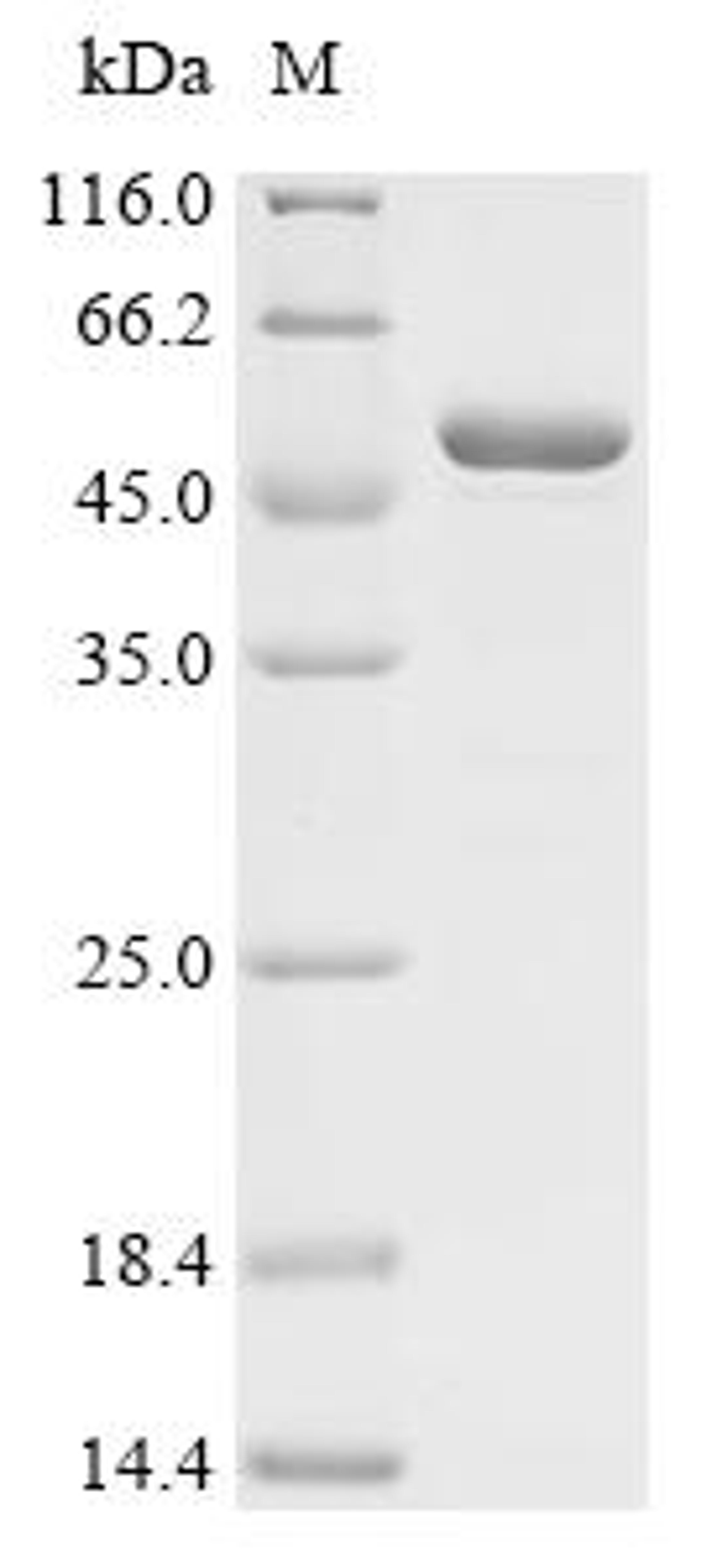 (Tris-Glycine gel) Discontinuous SDS-PAGE (reduced) with 5% enrichment gel and 15% separation gel.