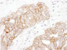 Detection of human Plakoglobin by immunohistochemistry.