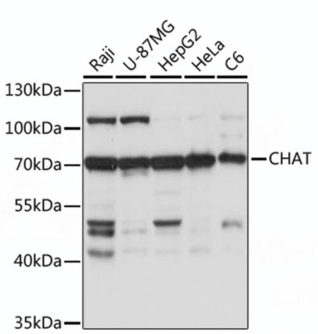 Western blot - CHAT antibody (A16818)