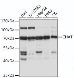 Western blot - CHAT antibody (A16818)