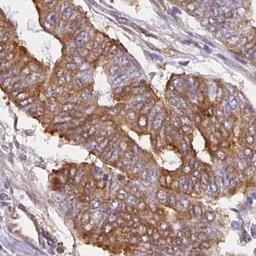 Immunohistochemistry: COX7B Antibody [NBP2-31703] - endometrial cancer