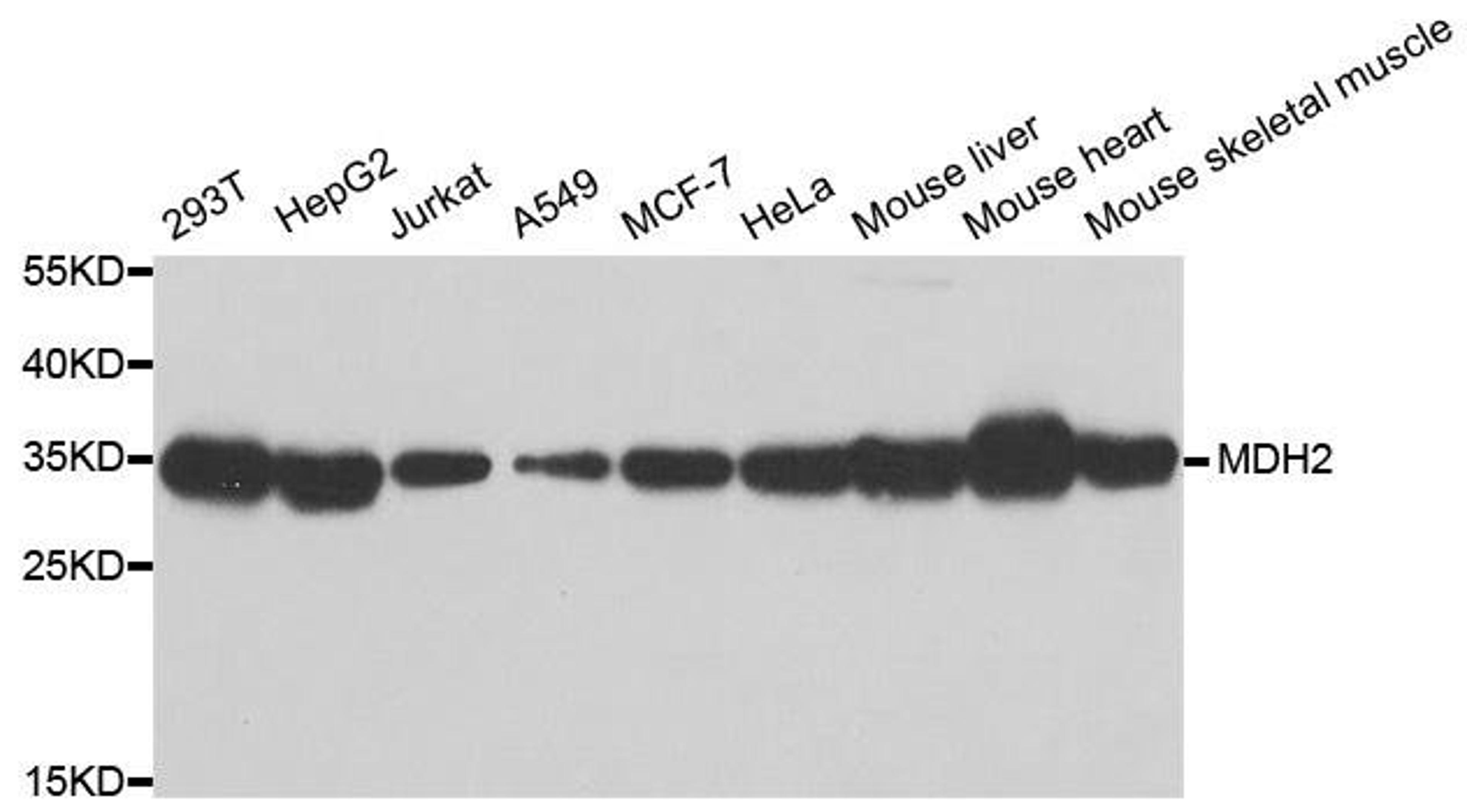 Western blot analysis of extracts of various cell lines using MDH2 antibody