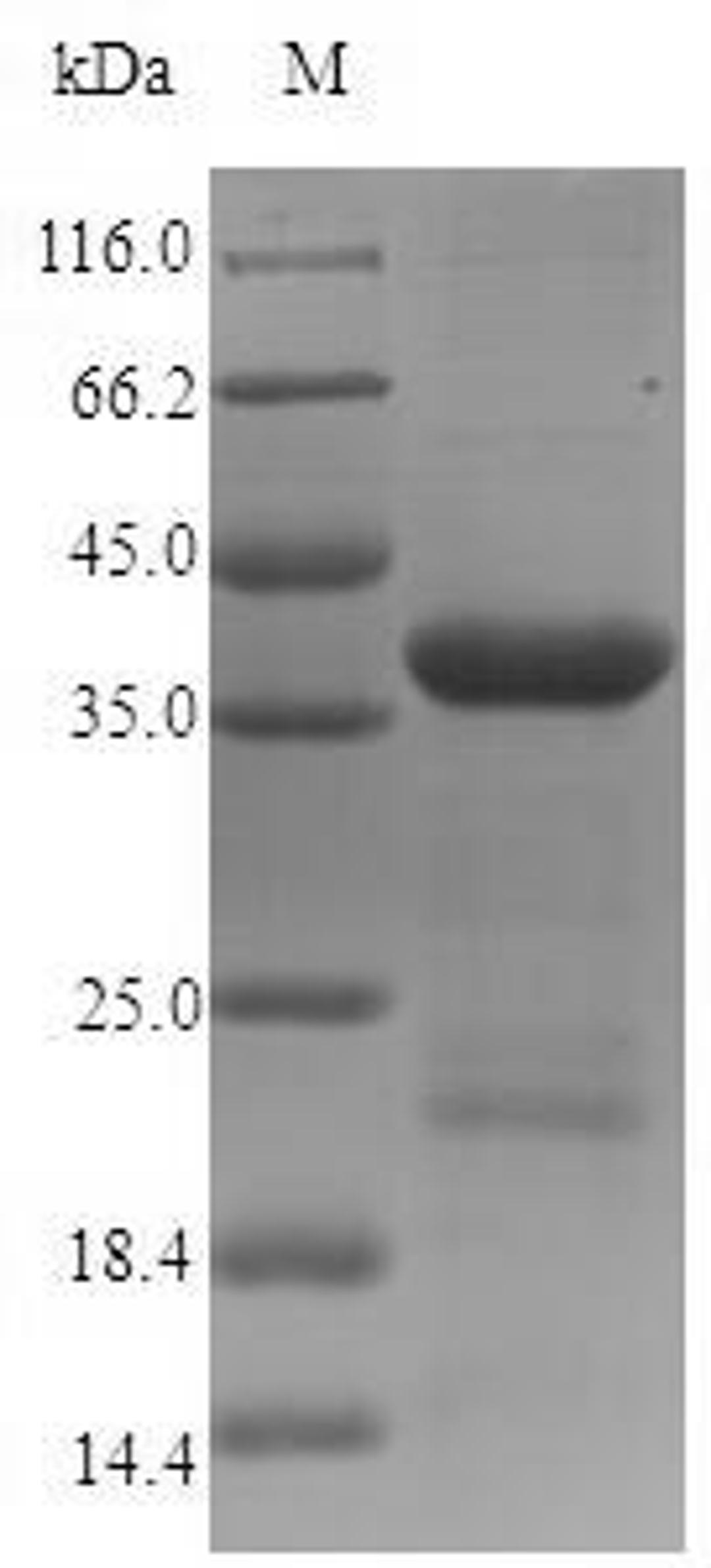 (Tris-Glycine gel) Discontinuous SDS-PAGE (reduced) with 5% enrichment gel and 15% separation gel.