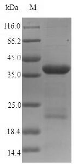 (Tris-Glycine gel) Discontinuous SDS-PAGE (reduced) with 5% enrichment gel and 15% separation gel.
