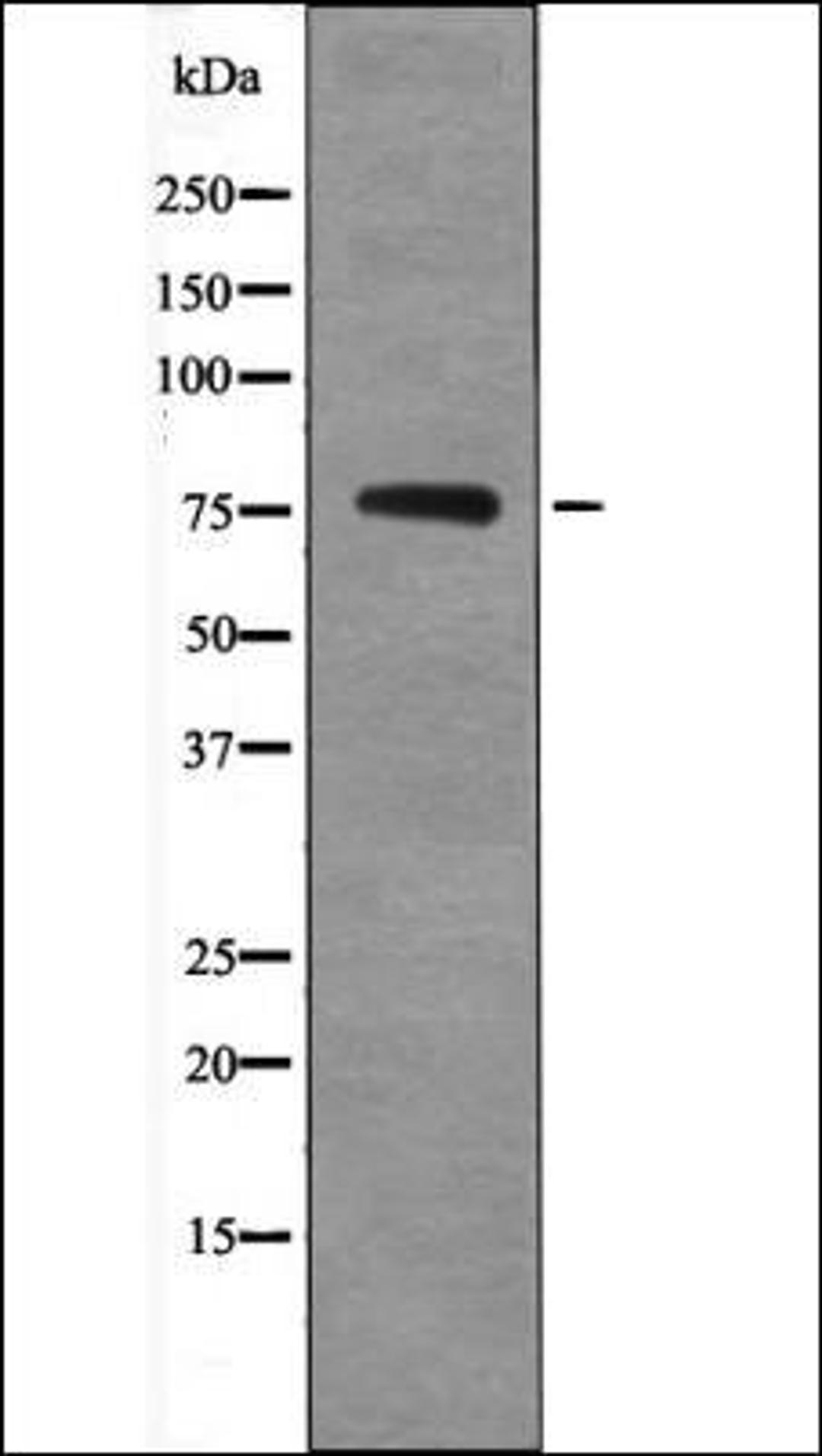 Western blot analysis of NIH-3T3 whole cell lysates using Tau -Phospho-Ser717/400- antibody