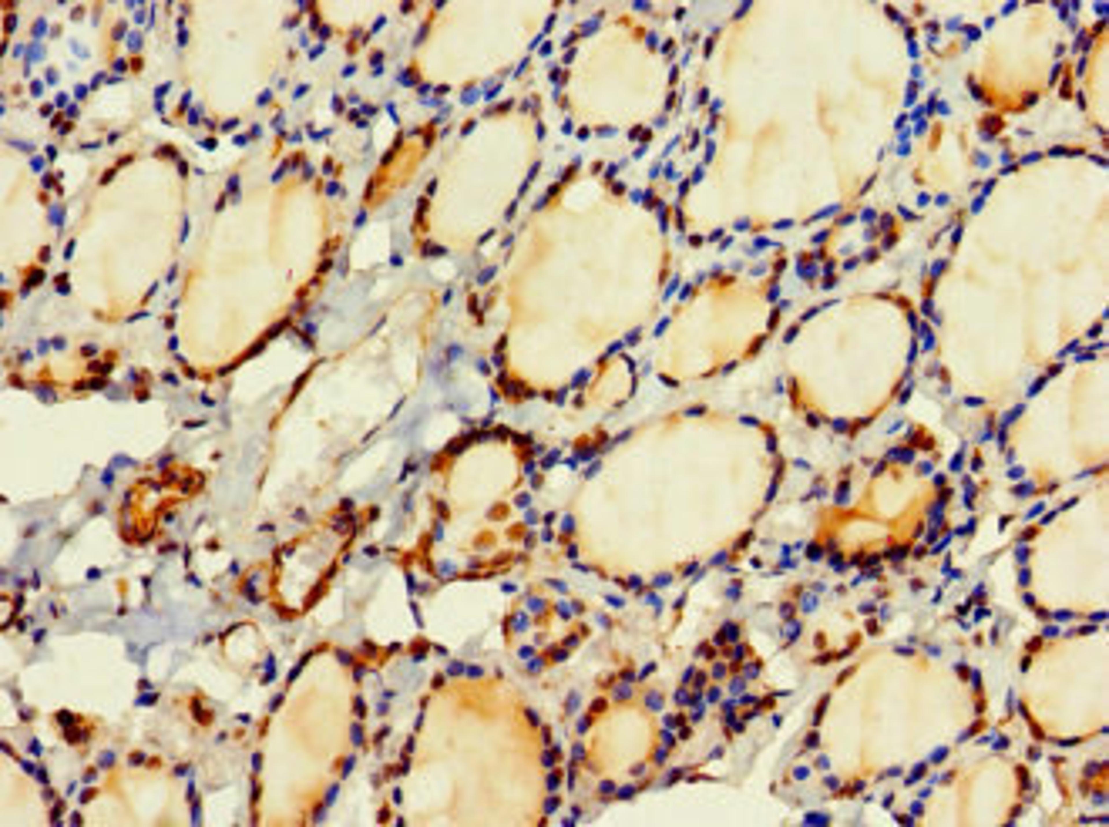 Immunohistochemistry of paraffin-embedded human thyroid tissue using CSB-PA880936LA01HU at dilution of 1:100