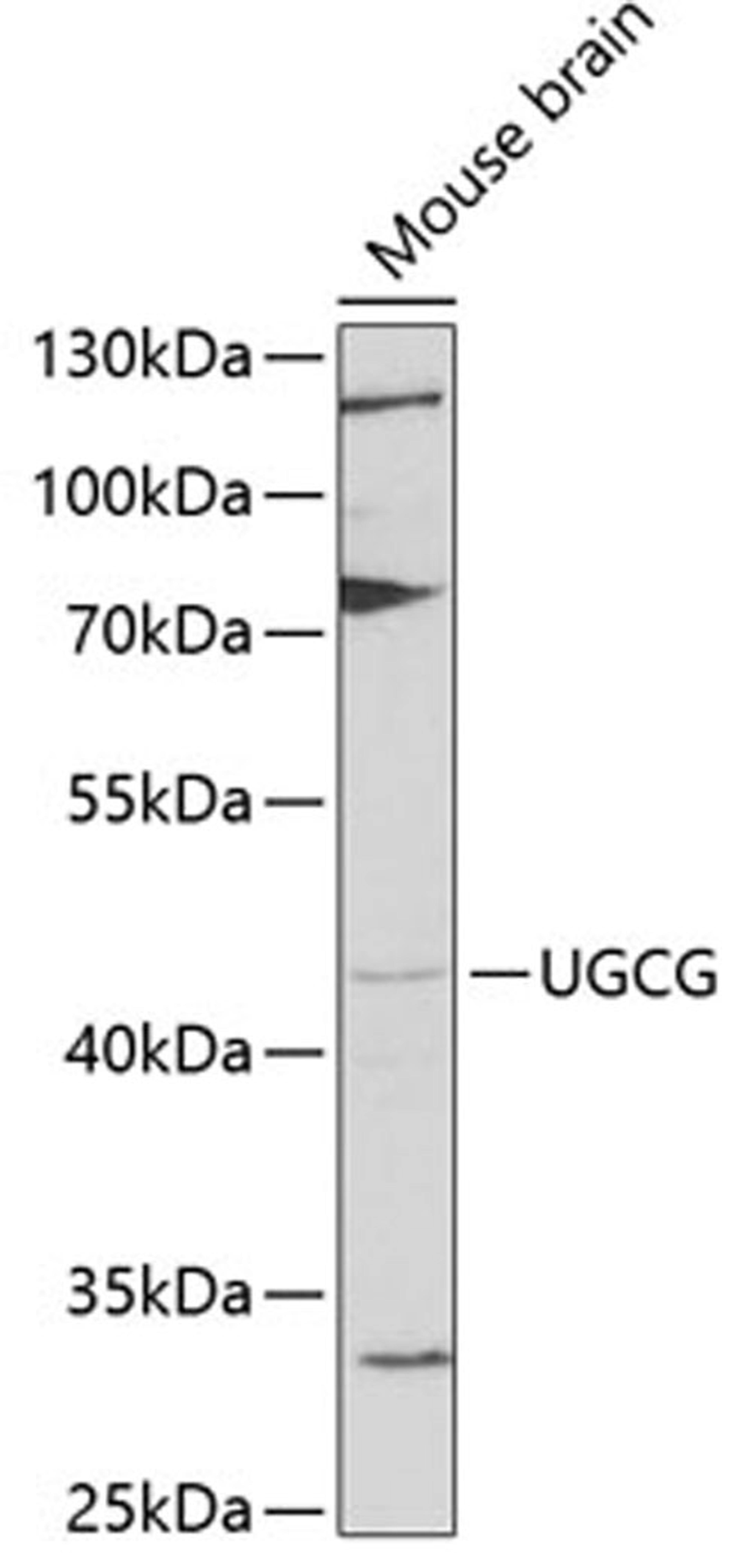 Western blot - UGCG antibody (A6317)