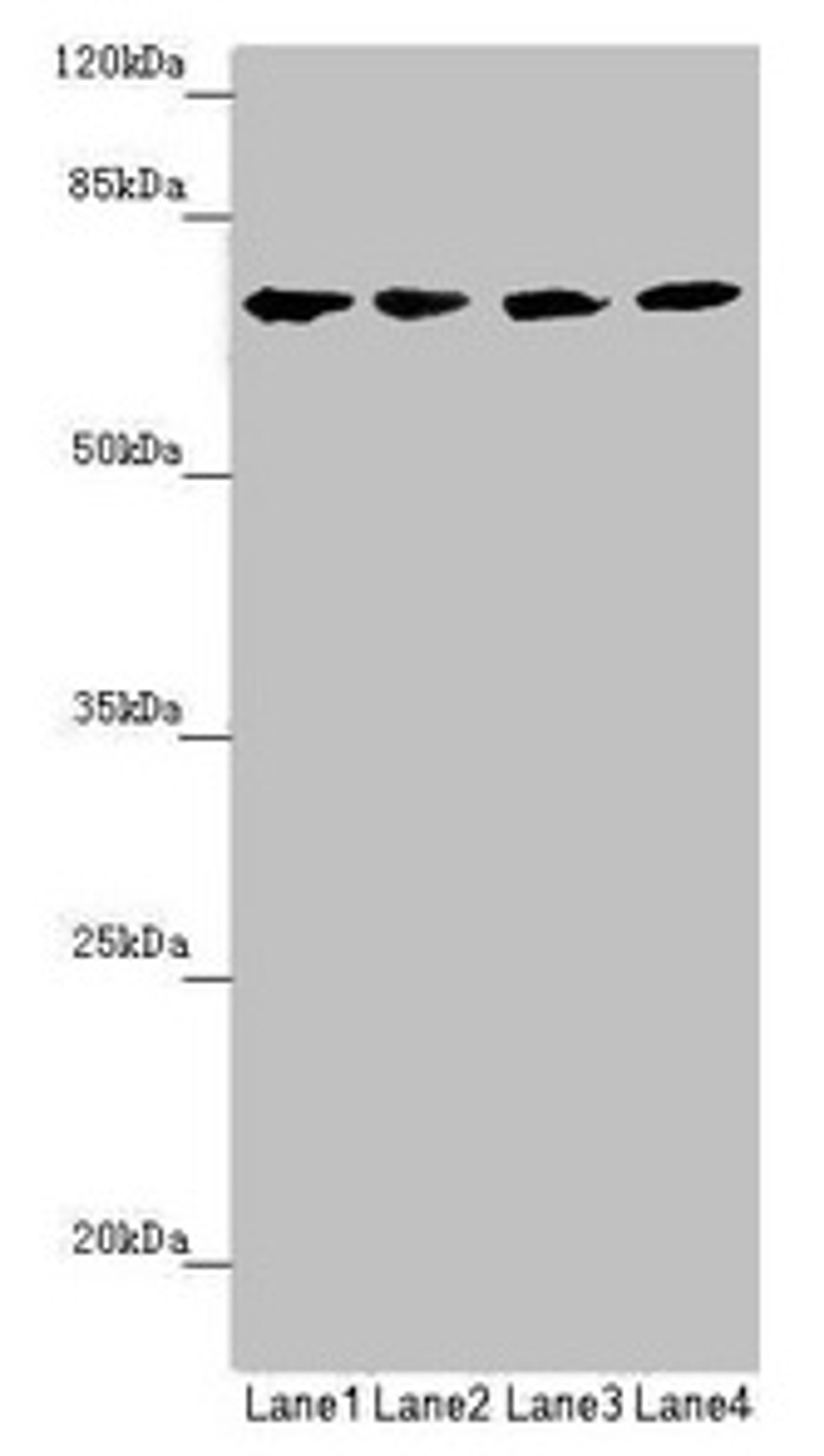 Western blot. All lanes: C8B antibody at 1.28µg/ml. Lane 1: Hela whole cell lysate. Lane 2: Jurkat whole cell lysate. Lane 3: Raji whole cell lysate. Lane 4: Mouse liver tissue. Secondary. Goat polyclonal to rabbit IgG at 1/10000 dilution. Predicted band size: 67 kDa. Observed band size: 67 kDa