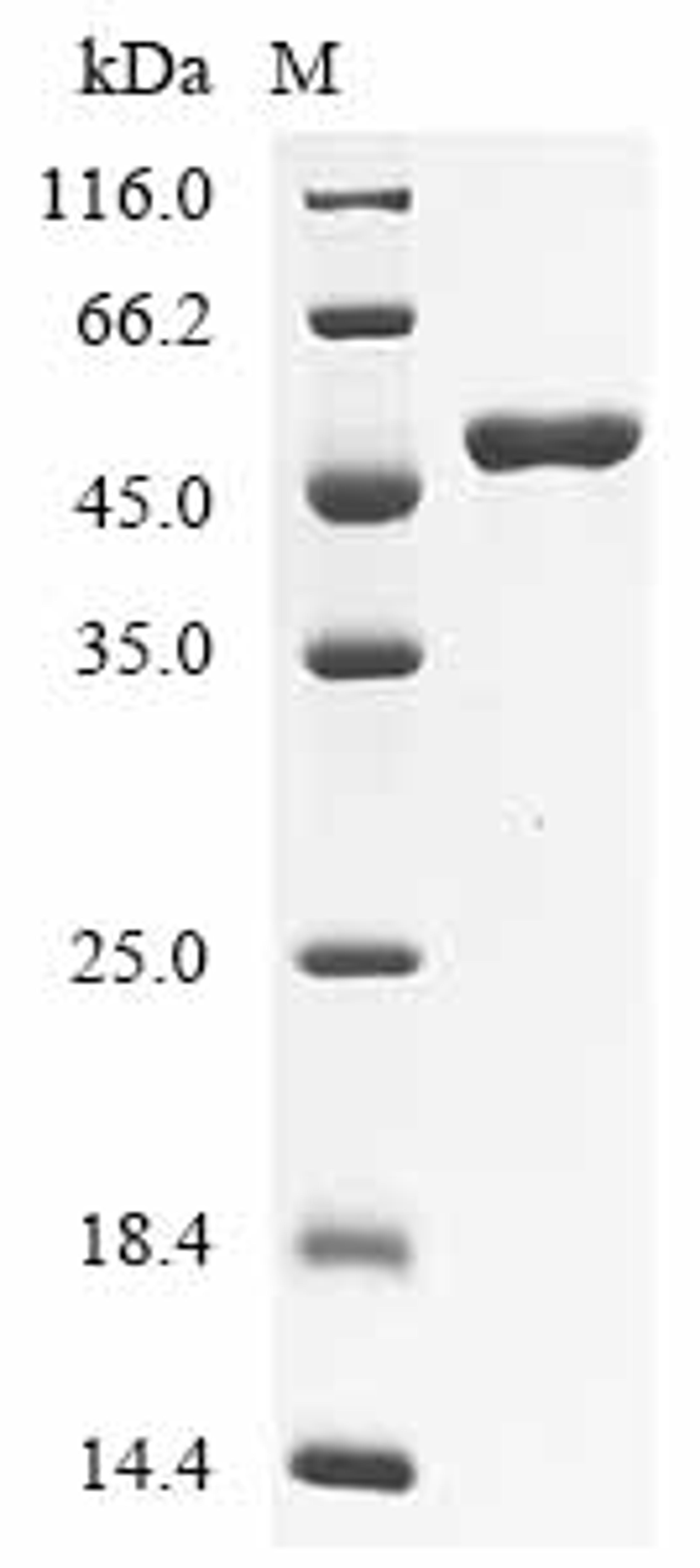 (Tris-Glycine gel) Discontinuous SDS-PAGE (reduced) with 5% enrichment gel and 15% separation gel.