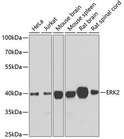 Western blot - ERK2 antibody (A0229)