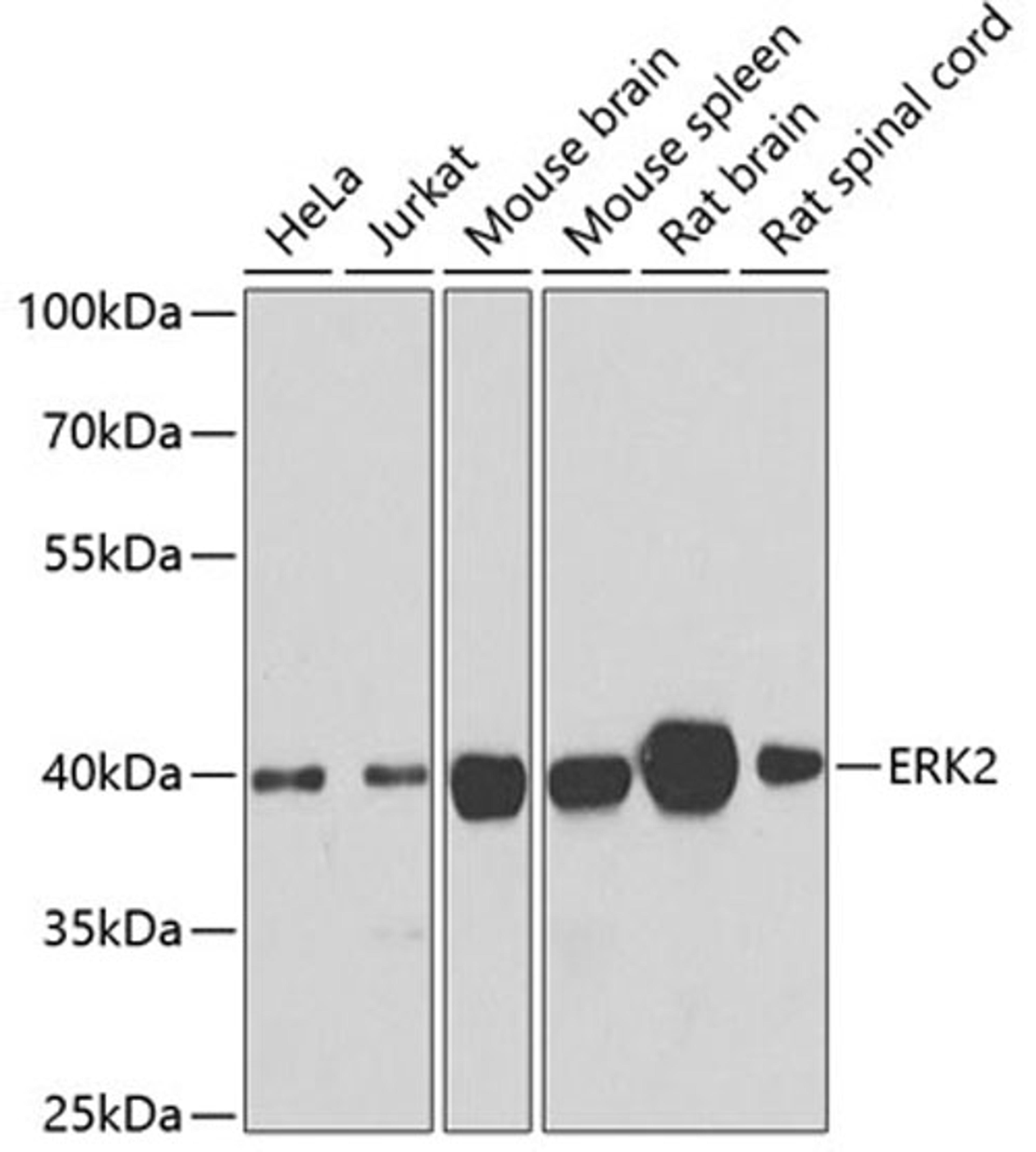 Western blot - ERK2 antibody (A0229)