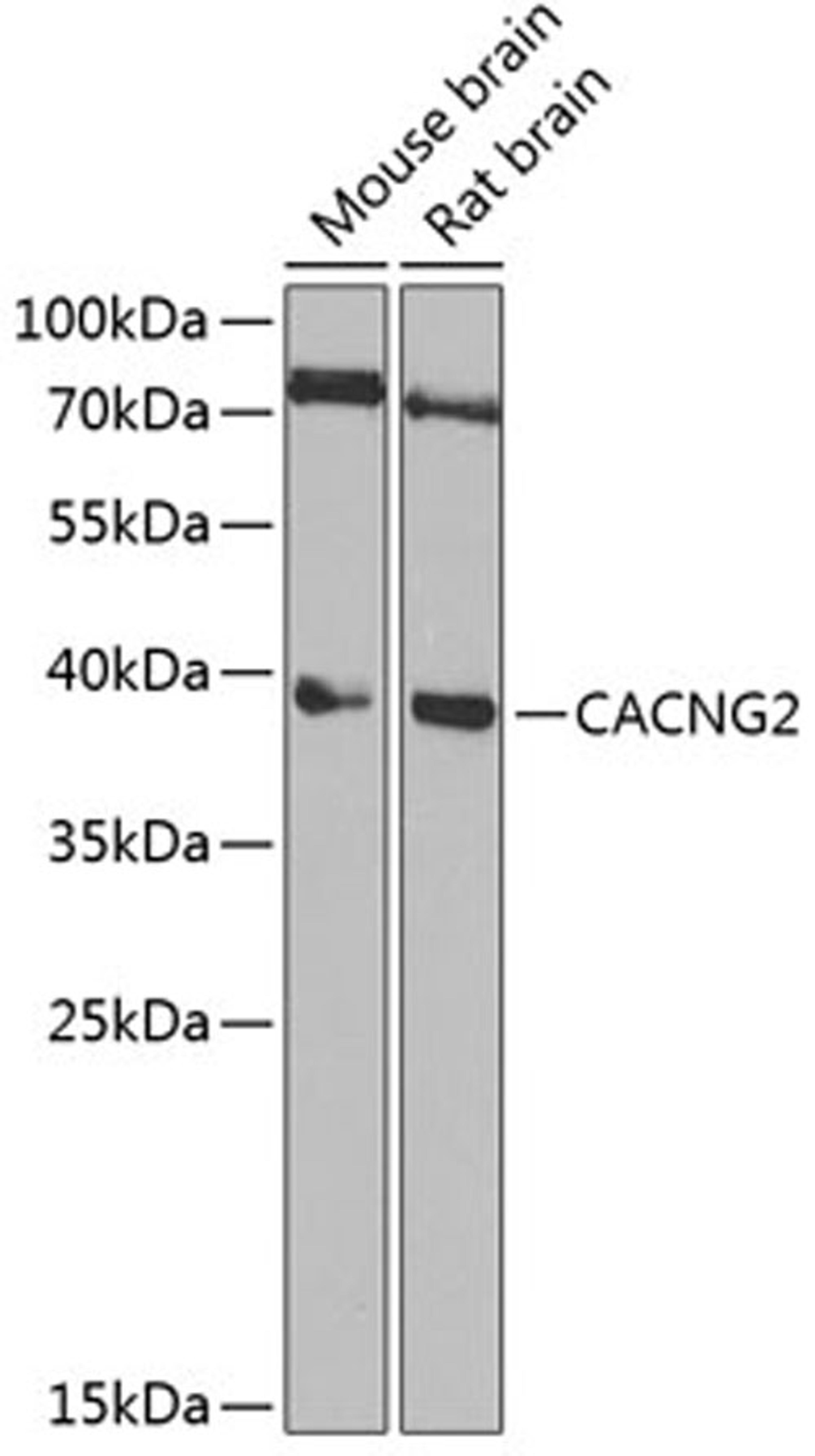 Western blot - CACNG2 Antibody (A6537)