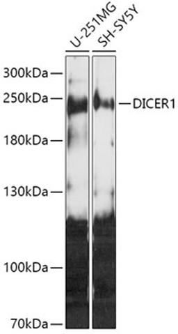 Western blot - DICER1 antibody (A6021)