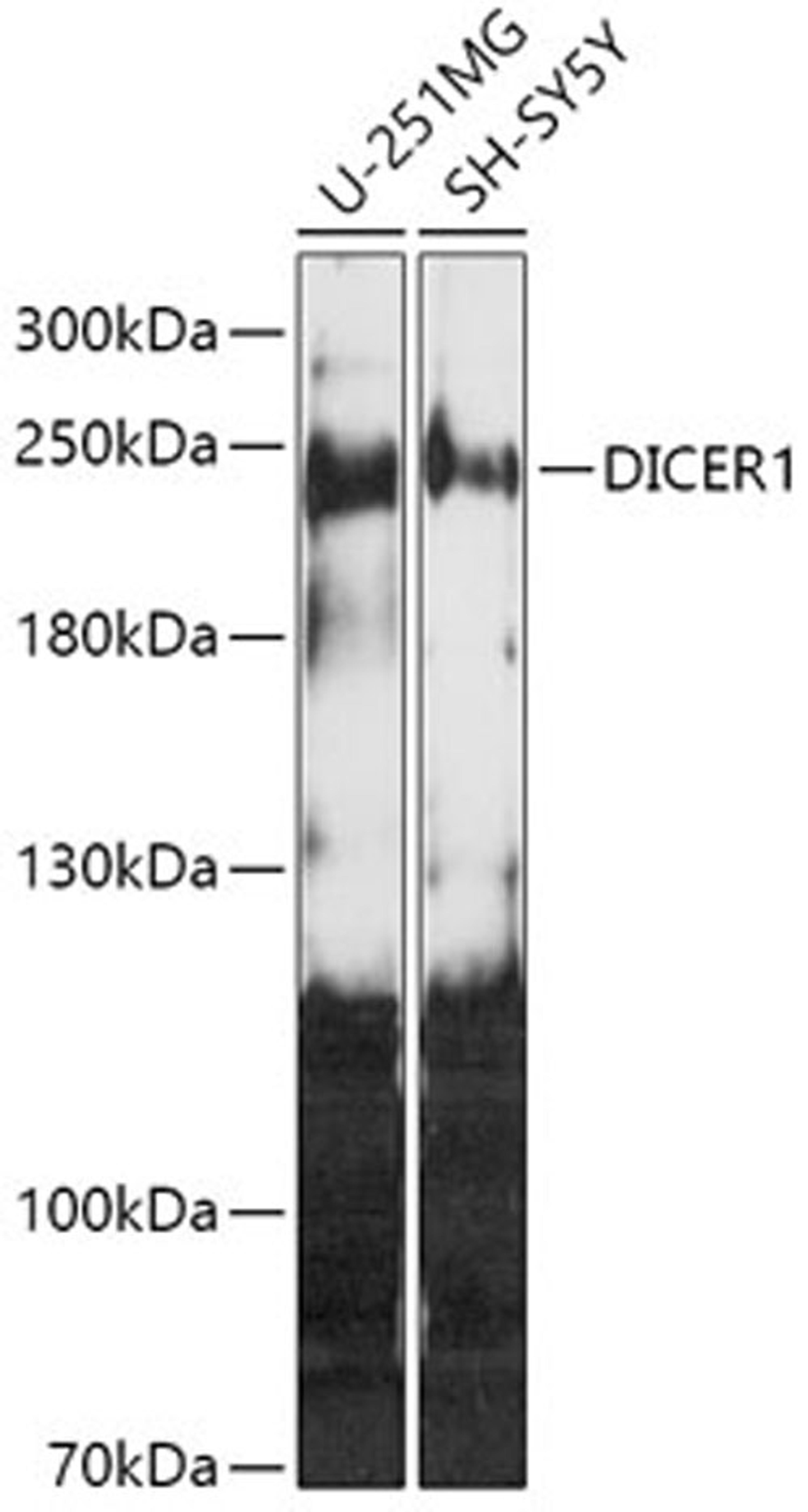 Western blot - DICER1 antibody (A6021)