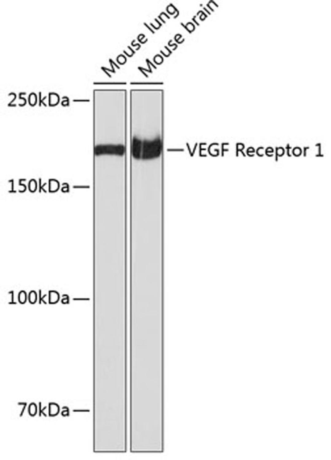 Western blot - VEGF Receptor 1 antibody (A19132)