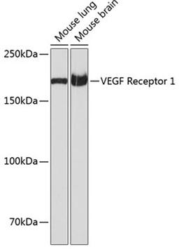 Western blot - VEGF Receptor 1 antibody (A19132)