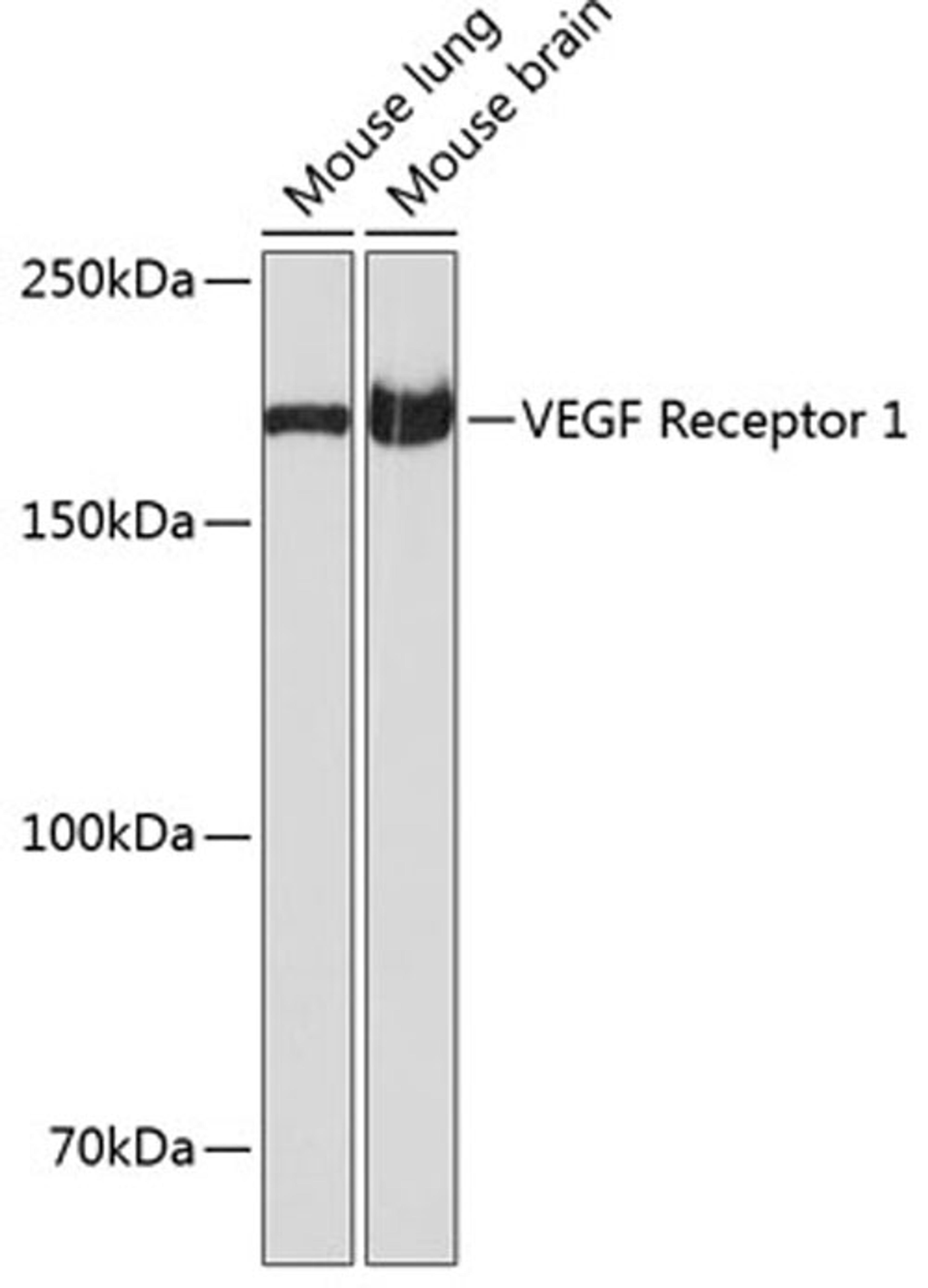 Western blot - VEGF Receptor 1 antibody (A19132)