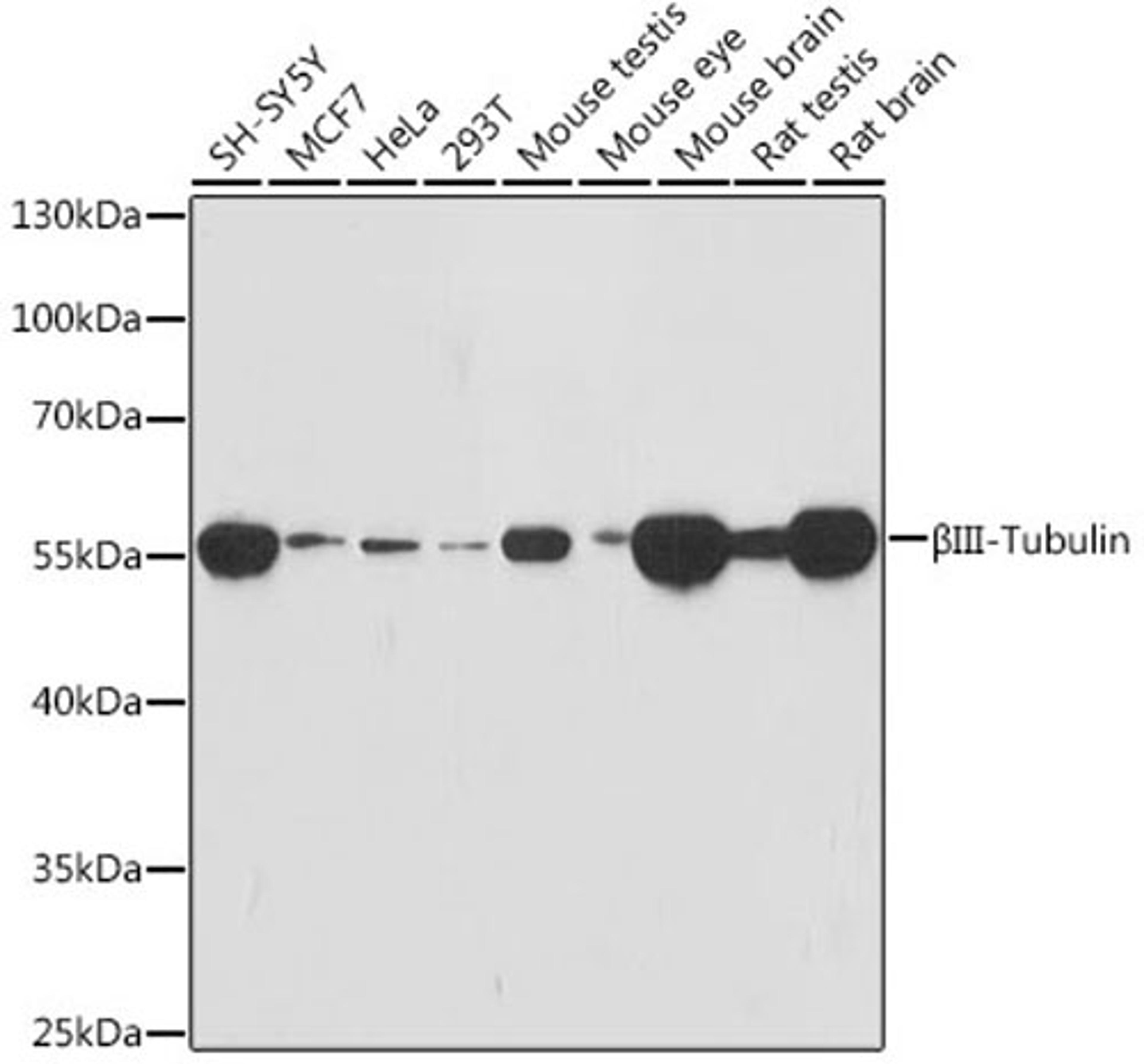 Western blot - TUBB3 antibody (A18132)