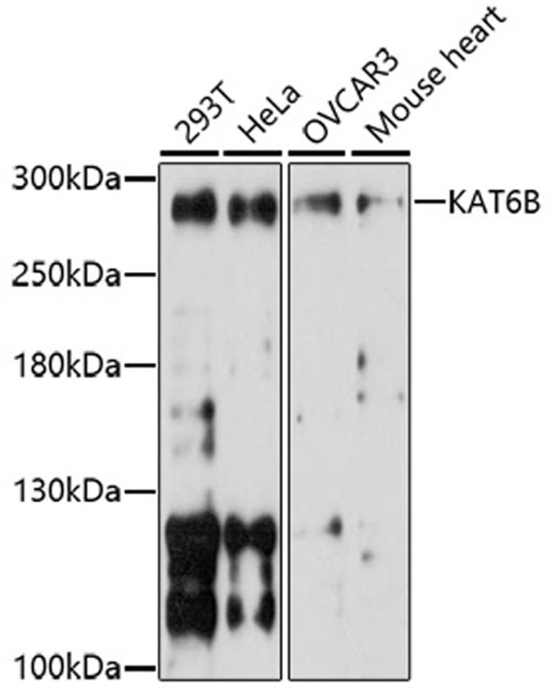 Western blot - KAT6B antibody (A17116)