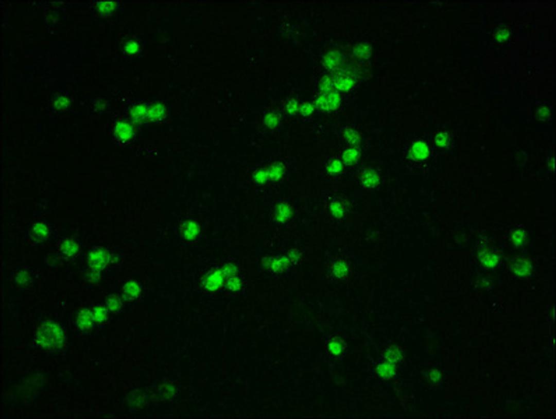 Immunofluorescence staining of 293T cells(treated with 50nM Calyculin A for 30min) with CSB-RA006169A33phHU at 1:100,counter-stained with DAPI. The cells were fixed in 4% formaldehyde, permeabilized using 0.2% Triton X-100 and blocked in 10% normal Goat Serum. The cells were then incubated with the antibody overnight at 4℃. The secondary antibody was Alexa Fluor 488-congugated AffiniPure Goat Anti-Rabbit IgG (H+L).