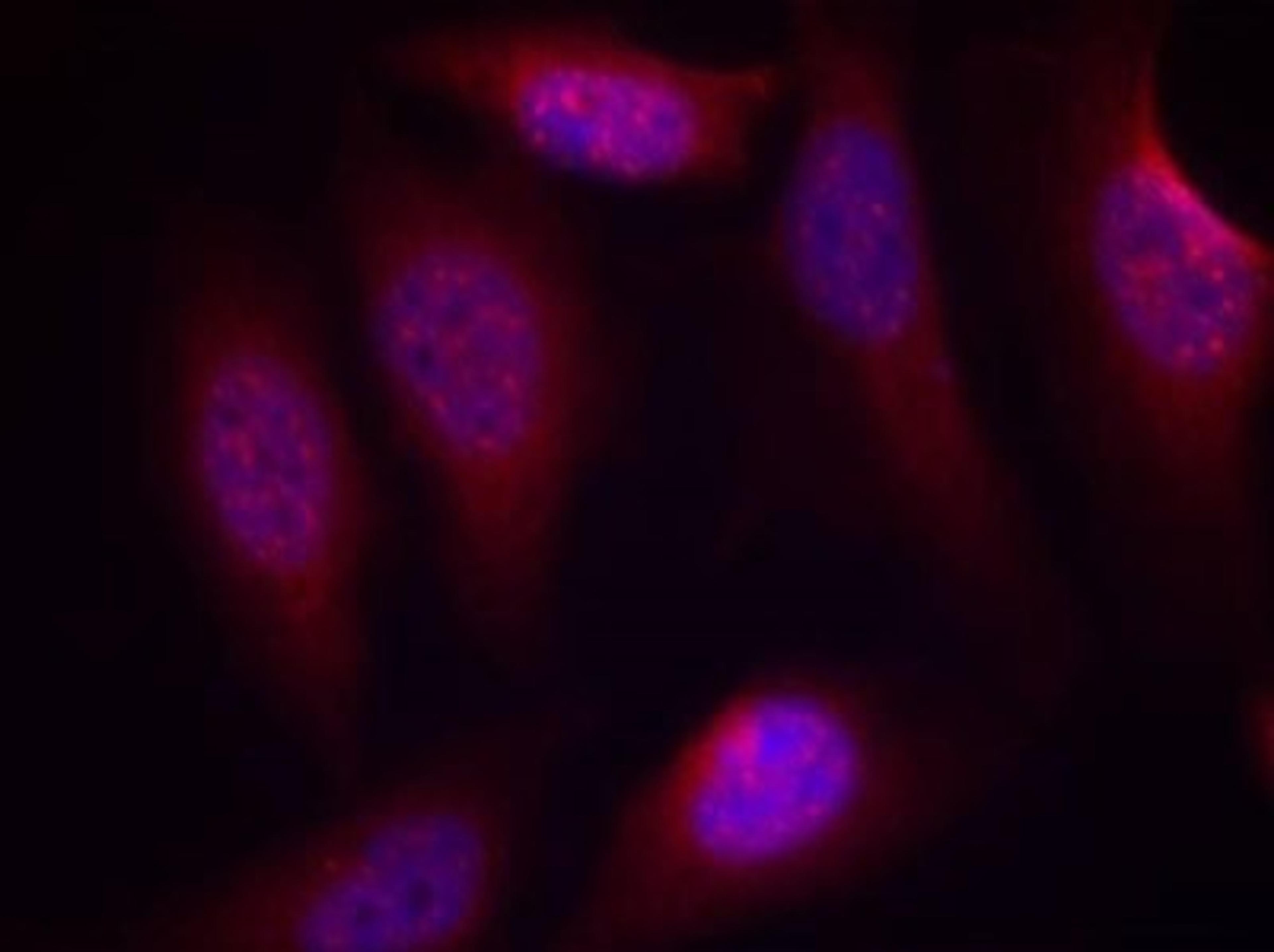 Immunocytochemistry/Immunofluorescence: MEK4 [p Ser80] Antibody [NB100-82184] - Staining of methanol-fixed Hela cells using SEK1/MKK4(Phospho-Ser80) antibody