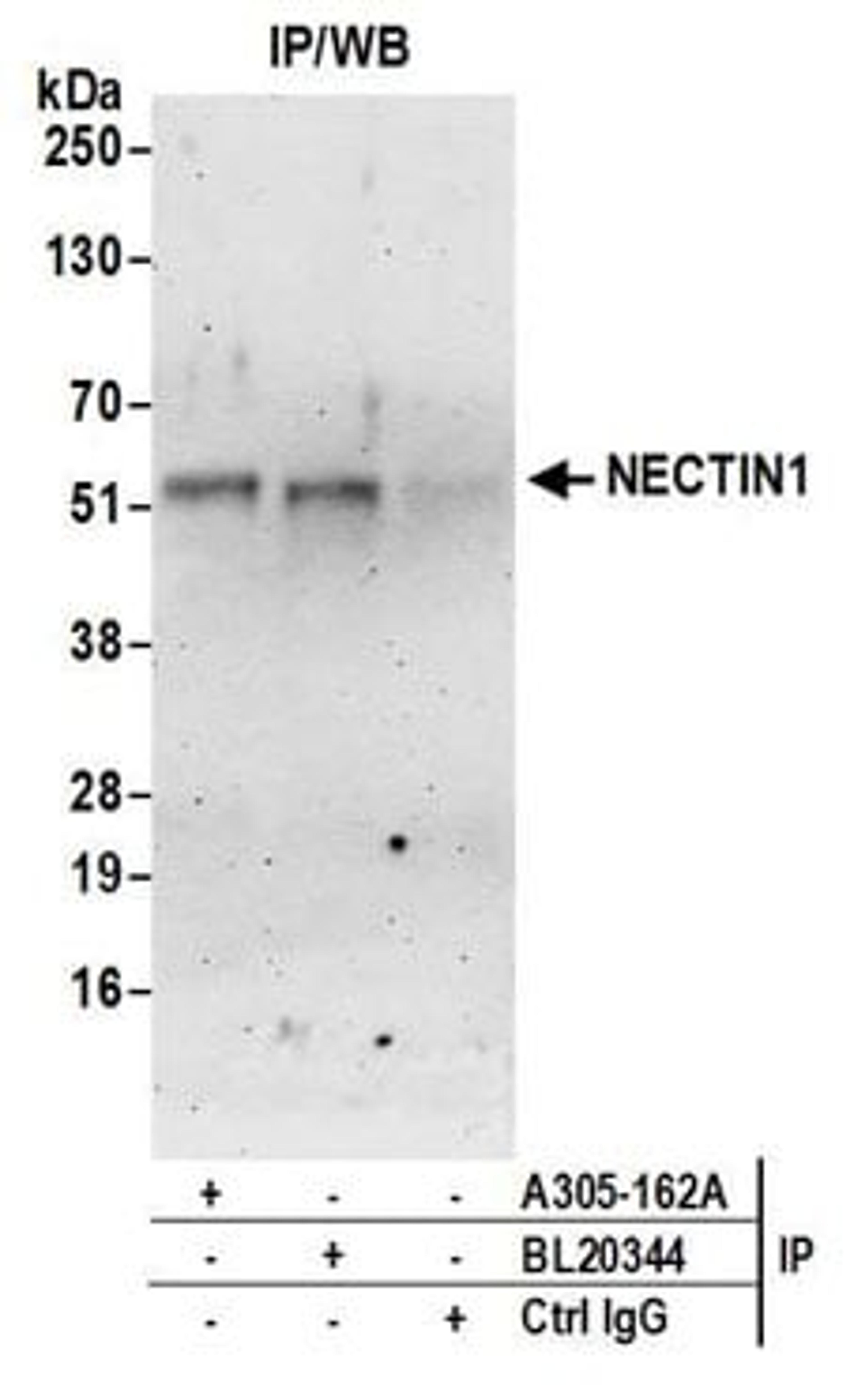 Detection of human NECTIN1 by western blot of immunoprecipitates.