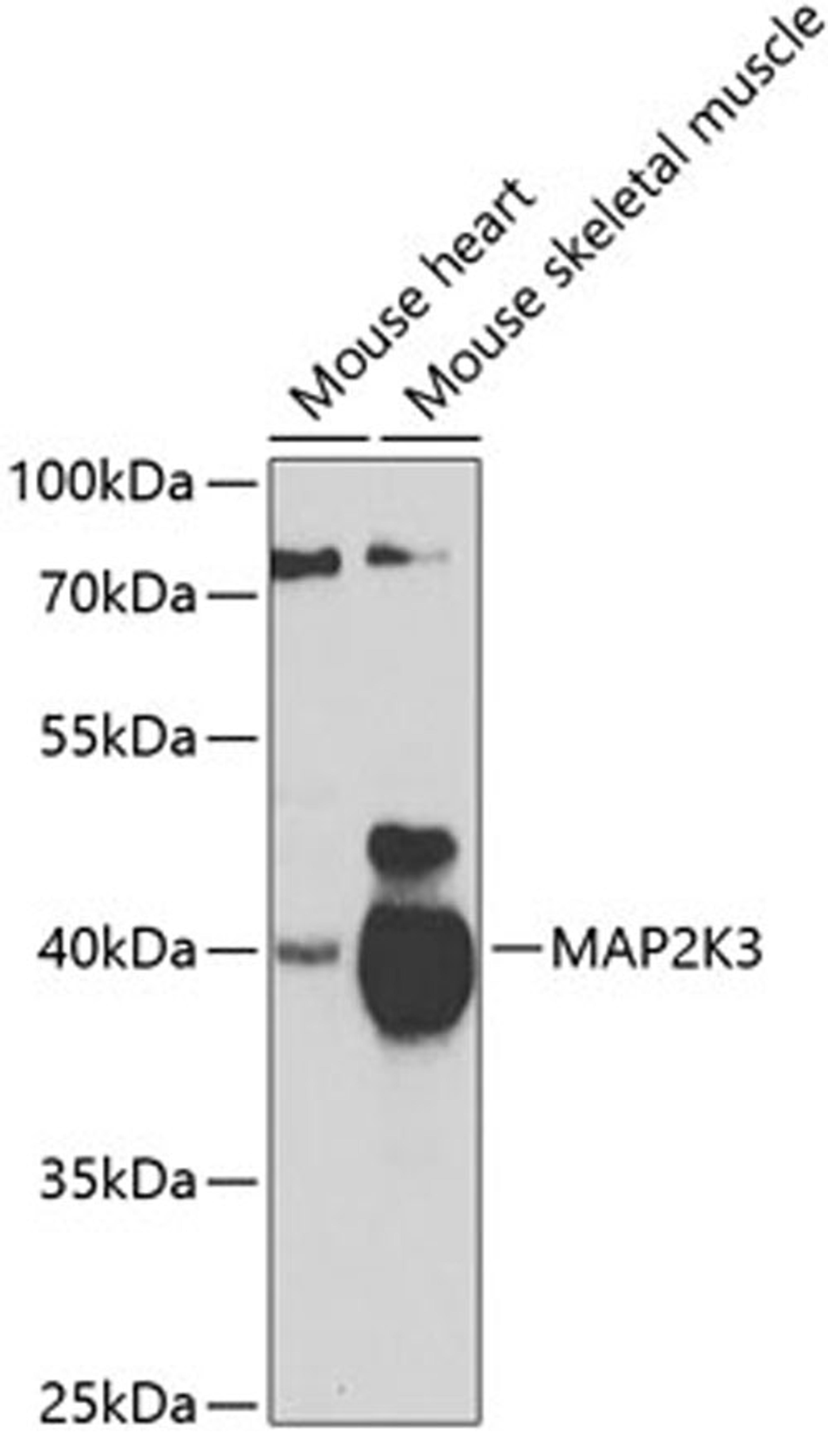 Western blot - MAP2K3 antibody (A7718)