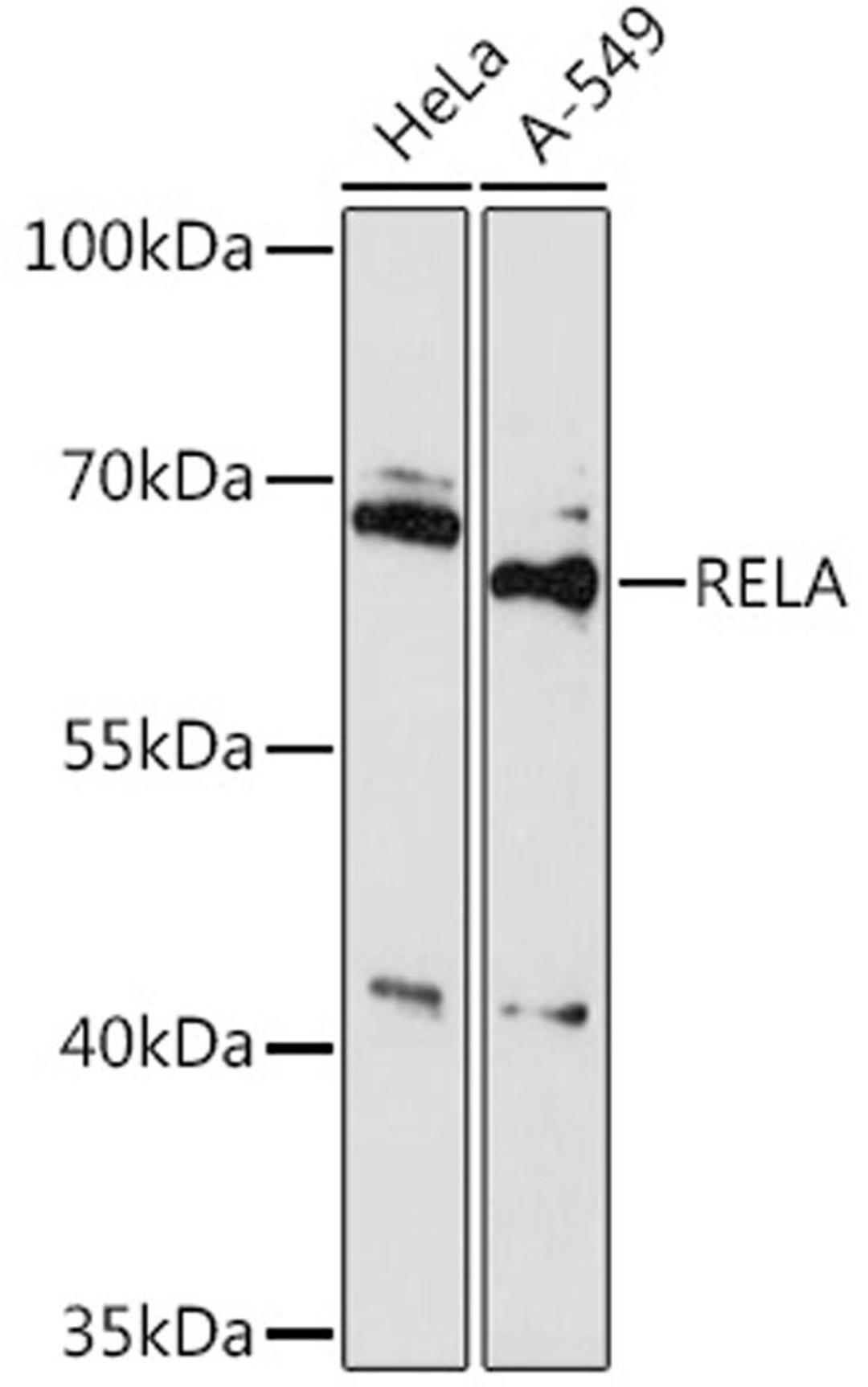 Western blot - RELA Rabbit pAb (A16728)