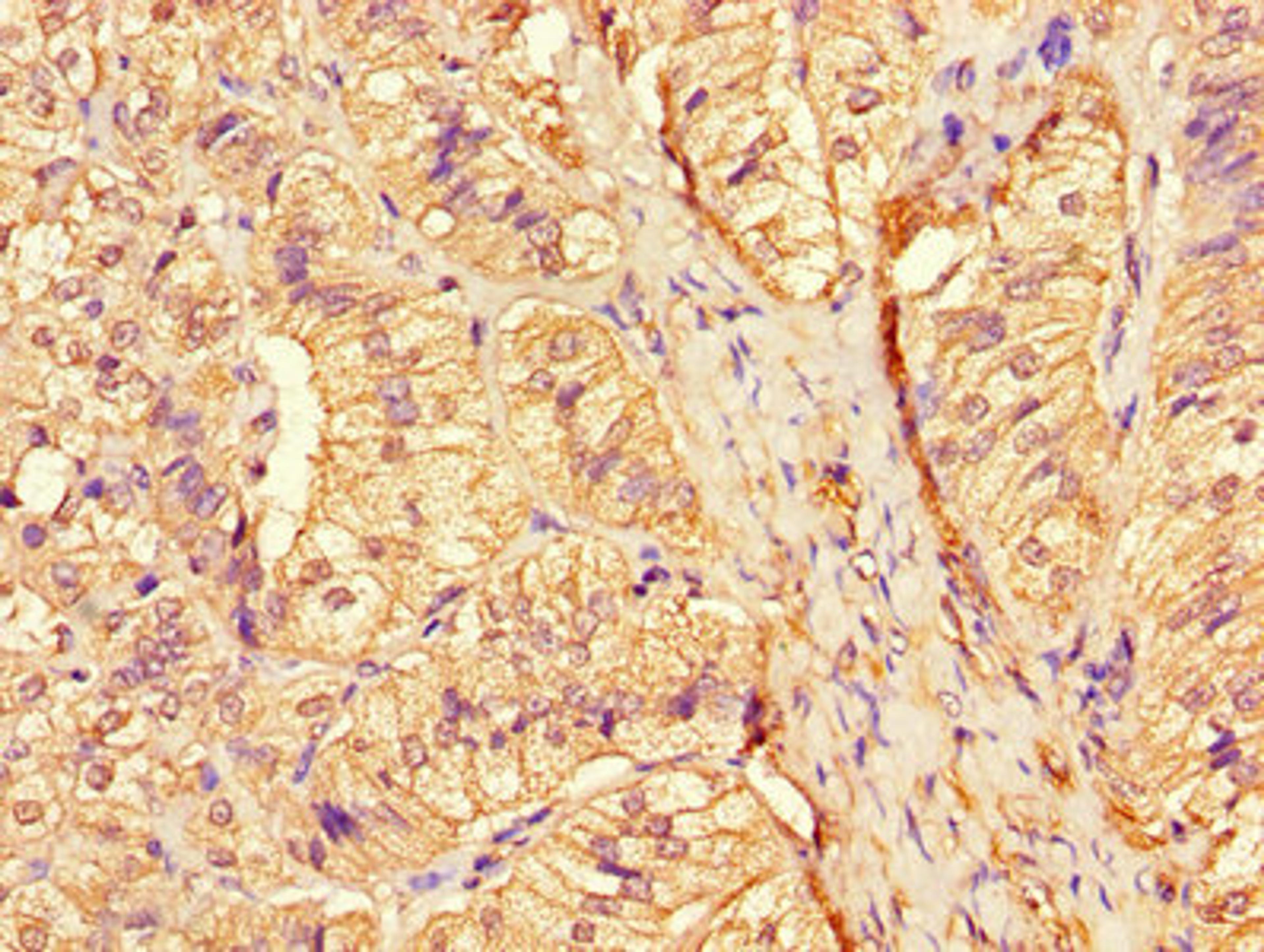 Immunohistochemistry of paraffin-embedded human adrenal gland tissue using CSB-PA006184LA01HU at dilution of 1:100