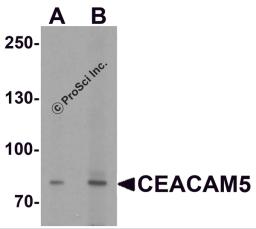 Western blot analysis of CEACAM5 in rat lung tissue lysate with CEACAM5 antibody at (A) 1 and (B) 2 &#956;g/ml.